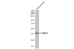 Invitrogen SMYD3 Recombinant Rabbit Monoclonal Antibody (HL2464) 100 &mu;L | Buy Online | Invitrogen&trade; | Fisher Scientific