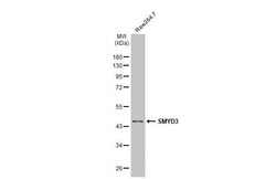 Invitrogen SMYD3 Recombinant Rabbit Monoclonal Antibody (HL2464) 100 &mu;L | Buy Online | Invitrogen&trade; | Fisher Scientific