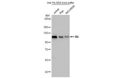 Invitrogen Rb Recombinant Rabbit Monoclonal Antibody (HL2465) 100 &mu;L;