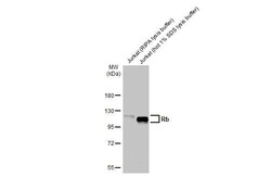 Invitrogen Rb Recombinant Rabbit Monoclonal Antibody (HL2465) 100 &mu;L;