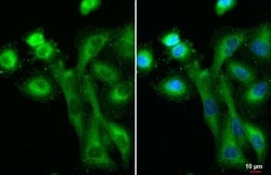 Invitrogen IFIT3 Recombinant Rabbit Monoclonal Antibody (HL246) 100 &mu;L;