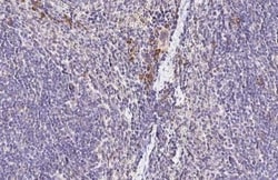 Invitrogen CCR4 Recombinant Rabbit Monoclonal Antibody (HL2481) 100 &mu;L;