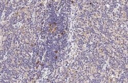 Invitrogen CCR4 Recombinant Rabbit Monoclonal Antibody (HL2481) 100 &mu;L;