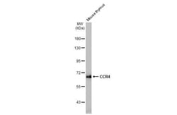 Invitrogen CCR4 Recombinant Rabbit Monoclonal Antibody (HL2481) 100 &mu;L;
