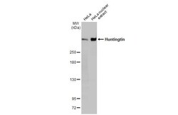 Invitrogen Huntingtin Recombinant Rabbit Monoclonal Antibody (HL2483) 100