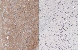 Invitrogen Phospho-Tau (Thr181) Recombinant Rabbit Monoclonal Antibody (HL2498) 100 &mu;L | Buy Online | Invitrogen&trade; | Fisher Scientific