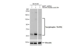 Invitrogen Phospho-Tau (Thr181) Recombinant Rabbit Monoclonal Antibody (HL2498) 100 &mu;L | Buy Online | Invitrogen&trade; | Fisher Scientific