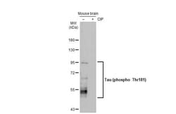 Invitrogen Phospho-Tau (Thr181) Recombinant Rabbit Monoclonal Antibody (HL2498) 100 &mu;L | Buy Online | Invitrogen&trade; | Fisher Scientific