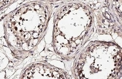 Invitrogen NEK2 Recombinant Rabbit Monoclonal Antibody (HL2511) 100 &mu;L;