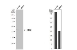 Invitrogen NEK2 Recombinant Rabbit Monoclonal Antibody (HL2511) 100 &mu;L;
