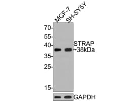 Invitrogen STRAP Monoclonal Antibody (A7H11) 100 &mu;L; Unconjugated:Antibodies,