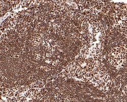 Invitrogen BRCA1 Monoclonal Antibody (A7E3) 100 &mu;L; Unconjugated:Antibodies,