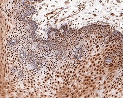 Invitrogen BRCA1 Monoclonal Antibody (A7E3) 100 &mu;L; Unconjugated:Antibodies,