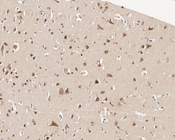 Invitrogen BRCA1 Monoclonal Antibody (A7E3) 100 &mu;L; Unconjugated:Antibodies,