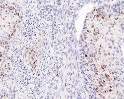Invitrogen p21 Monoclonal Antibody (A8C12) 100 &mu;L; Unconjugated:Antibodies,