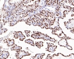 Invitrogen p21 Monoclonal Antibody (A8C11) 100 &mu;L | Buy Online | Invitrogen&trade; | Fisher Scientific