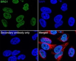 Invitrogen BRG1 Monoclonal Antibody (A5C9) 100 &mu;L; Unconjugated:Antibodies,