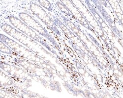 Invitrogen MUM1 Monoclonal Antibody (A7C12) 100 &mu;L; Unconjugated:Antibodies,