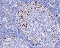 Invitrogen MUM1 Monoclonal Antibody (A7C12) 100 &mu;L; Unconjugated:Antibodies,