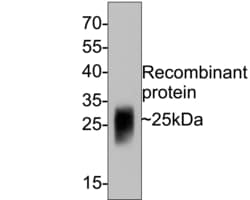 Invitrogen GM-CSF Monoclonal Antibody (A6C5) 100 &mu;L; Unconjugated:Antibodies,