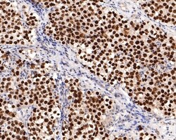 Invitrogen SALL4 Monoclonal Antibody (A7A5) 100 &mu;L; Unconjugated:Antibodies,