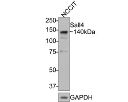 Invitrogen SALL4 Monoclonal Antibody (A7A5) 100 &mu;L; Unconjugated:Antibodies,