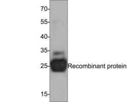 Invitrogen IL-6 Monoclonal Antibody (A6D2) 100 &mu;L; Unconjugated:Antibodies,