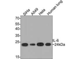 Invitrogen IL-6 Monoclonal Antibody (A6D1) 100 &mu;L | Buy Online | Invitrogen&trade; | Fisher Scientific