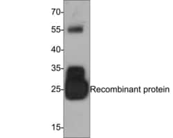 Invitrogen IL-6 Monoclonal Antibody (A6D1) 100 &mu;L | Buy Online | Invitrogen&trade; | Fisher Scientific