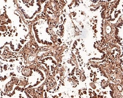Invitrogen K-Ras Monoclonal Antibody (A8E5) 100 &mu;L; Unconjugated:Antibodies,