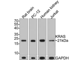 Invitrogen K-Ras Monoclonal Antibody (A8E5) 100 &mu;L; Unconjugated:Antibodies,