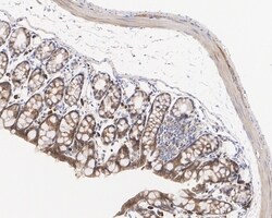 Invitrogen K-Ras Monoclonal Antibody (A8E6) 100 &mu;L; Unconjugated:Antibodies,