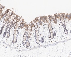 Invitrogen K-Ras Monoclonal Antibody (A8E6) 100 &mu;L; Unconjugated:Antibodies,
