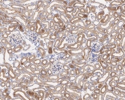 Invitrogen K-Ras Monoclonal Antibody (A8E6) 100 &mu;L; Unconjugated:Antibodies,