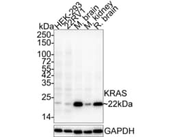 Invitrogen K-Ras Monoclonal Antibody (A8E6) 100 &mu;L; Unconjugated:Antibodies,