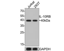 Invitrogen IL10RB Monoclonal Antibody (A8E11) 100 &mu;L; Unconjugated:Antibodies,