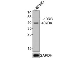 Invitrogen IL10RB Monoclonal Antibody (A8E11) 100 &mu;L; Unconjugated:Antibodies,