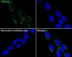 Invitrogen TMED9 Monoclonal Antibody (A9A8) 100 &mu;L; Unconjugated:Antibodies,