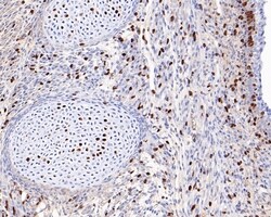 Invitrogen BrdU Monoclonal Antibody (A9C6) 100 &mu;L | Buy Online | Invitrogen&trade; | Fisher Scientific