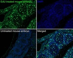 Invitrogen BrdU Monoclonal Antibody (A9C6) 100 &mu;L | Buy Online | Invitrogen&trade; | Fisher Scientific