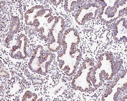 Invitrogen CUX1/Protein CASP Monoclonal Antibody (A9F6) 100 &mu;L; Unconjugated:Antibodies,