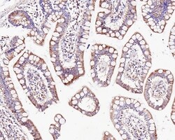 Invitrogen CUX1/Protein CASP Monoclonal Antibody (A9F6) 100 &mu;L; Unconjugated:Antibodies,