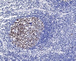 Invitrogen Ki-67 Recombinant Mouse Monoclonal Antibody (PD00-10) 100 &mu;L | Buy Online | Invitrogen&trade; | Fisher Scientific