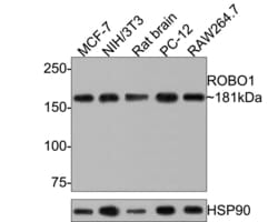 Invitrogen ROBO1 Recombinant Mouse Monoclonal Antibody (10E2-R) 100 &mu;L;
