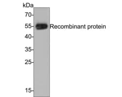 Invitrogen PIEZO1 Recombinant Mouse Monoclonal Antibody (2-10-R-A) 100 &mu;L | Buy Online | Invitrogen&trade; | Fisher Scientific
