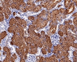 Invitrogen ASS1 Recombinant Mouse Monoclonal Antibody (11F1-RA) 100 &mu;L | Buy Online | Invitrogen&trade; | Fisher Scientific