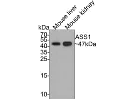 Invitrogen ASS1 Recombinant Mouse Monoclonal Antibody (11F1-RA) 100 &mu;L | Buy Online | Invitrogen&trade; | Fisher Scientific