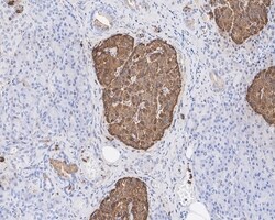 Invitrogen Chromogranin A Recombinant Mouse Monoclonal Antibody (PD01-39)