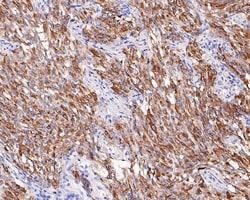 Invitrogen Chromogranin A Recombinant Mouse Monoclonal Antibody (PD01-39)