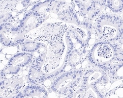 Invitrogen Chromogranin A Recombinant Mouse Monoclonal Antibody (PD01-39)